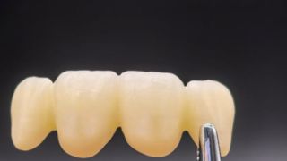 Zirkonia Master 4D Audental