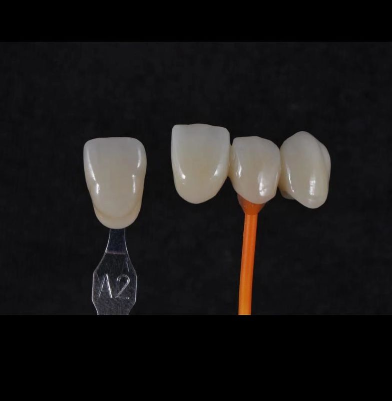 3D Pro Zirconia Dental Putih CAD CAM Blok 98/95/92mm Sistem Terbuka CE