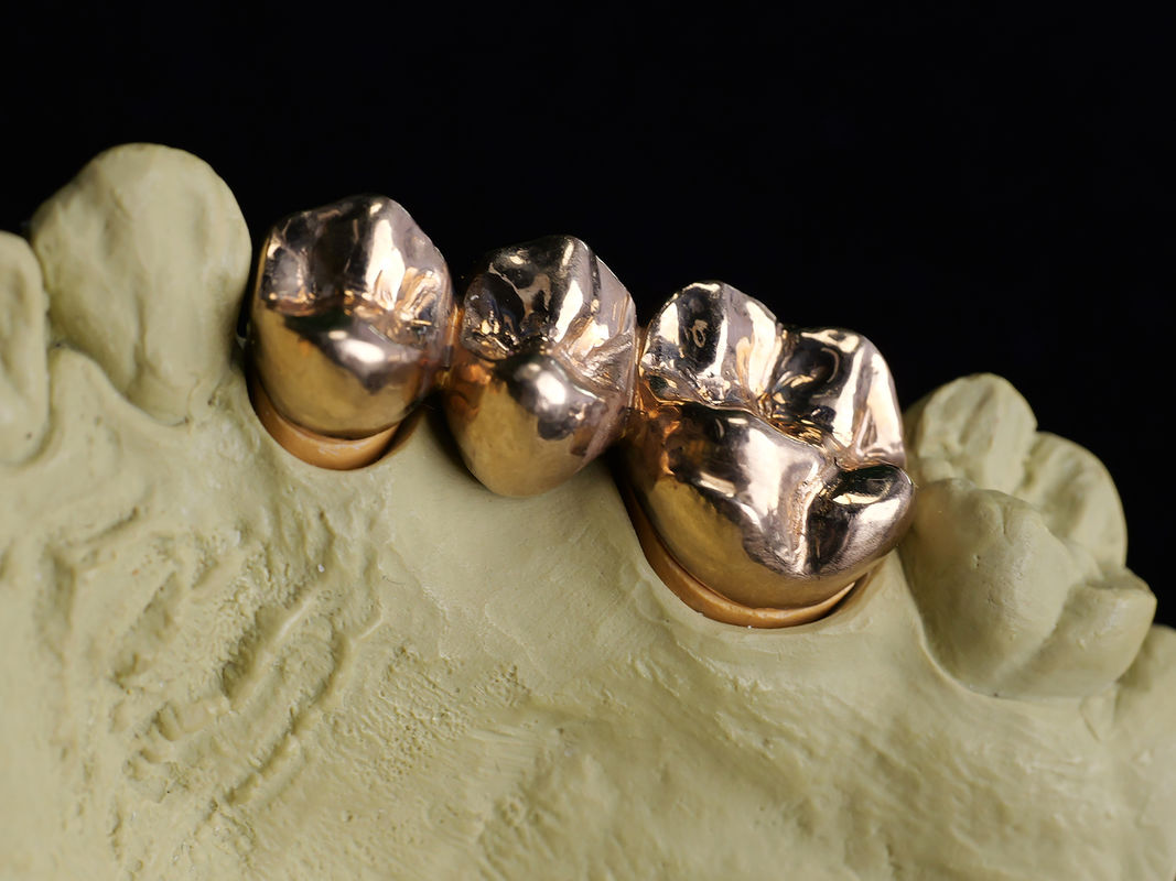 Audental A75 Noble Alloy HIGH NOBL Kuning Au75% untuk Restorasi Mahkota Jembatan