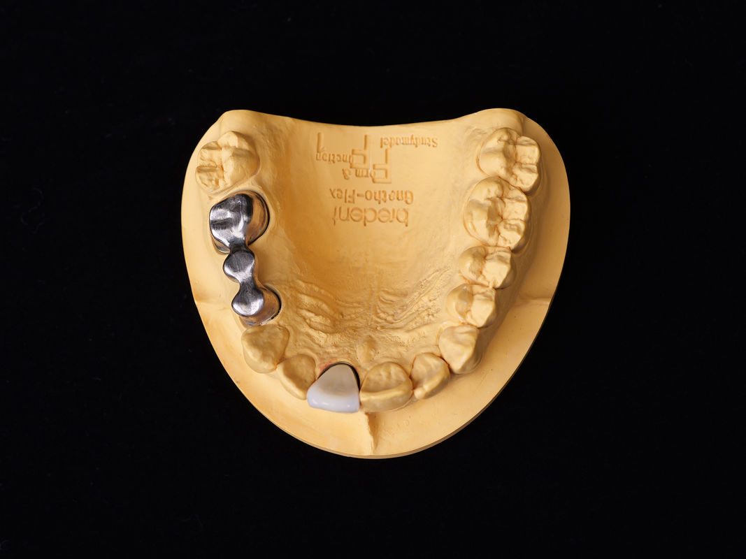 Audental 04 Noble Alloy Perak-Palladium Porselin Alloy Putih Pd53.3% untuk restorasi gigi tahan lama