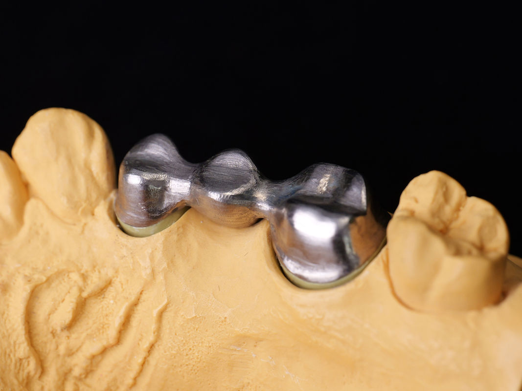 Audental 04 Noble Alloy Perak-Palladium Porselin Alloy Putih Pd53.3% untuk restorasi gigi tahan lama
