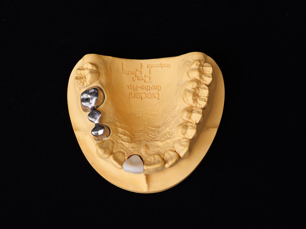 Audental 43 Perak-Palladium Porselin Alloy Putih Pd43% Alloy mulia Untuk restorasi gigi yang kuat dan estetis