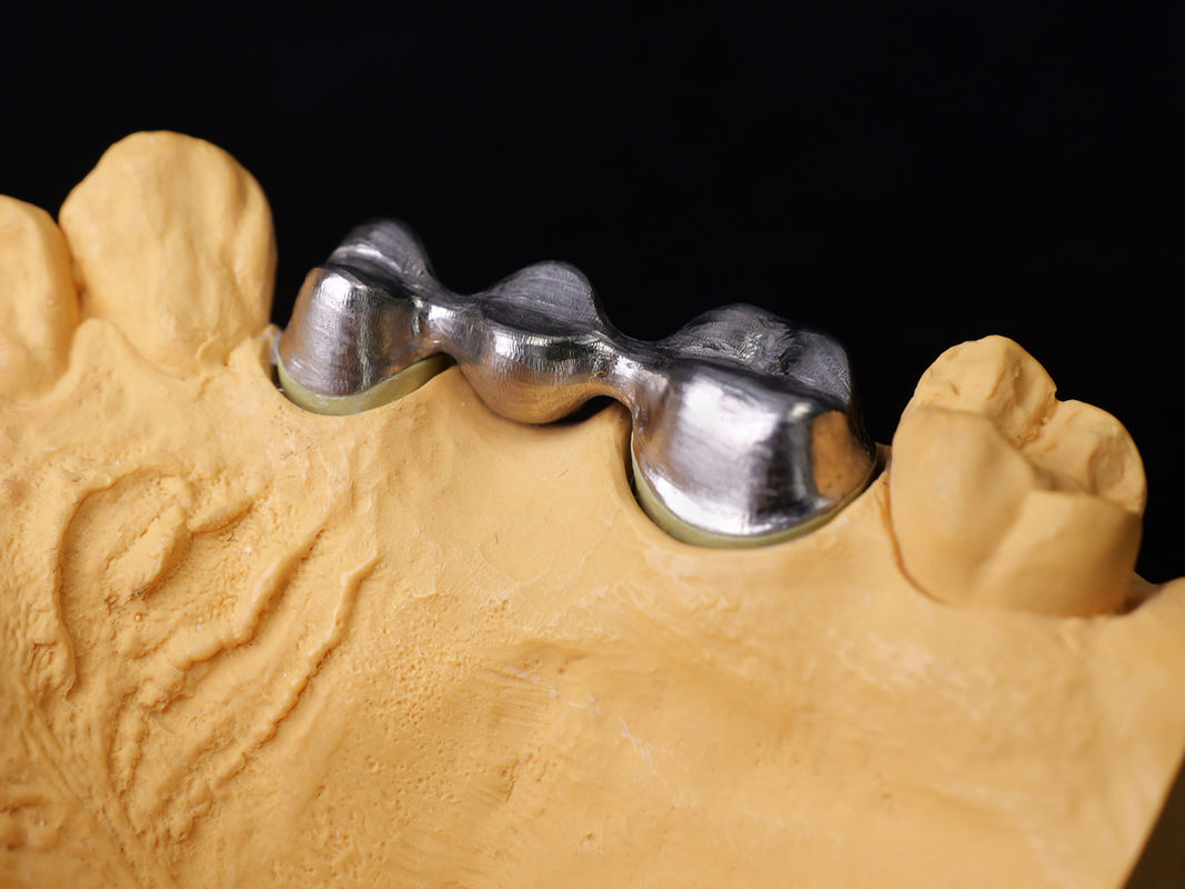 Audental 43 Perak-Palladium Porselin Alloy Putih Pd43% Alloy mulia Untuk restorasi gigi yang kuat dan estetis